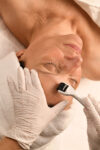 NEU: Microneedling – 1. Behandlung