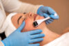 Microneedling – Folgebehandlung