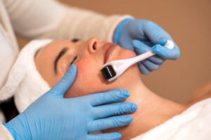 Anwendung: Microneedling – Folgebehandlung