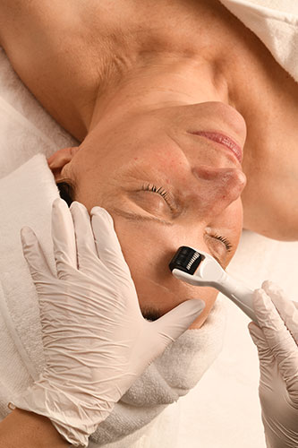 NEU: Microneedling – 1. Behandlung